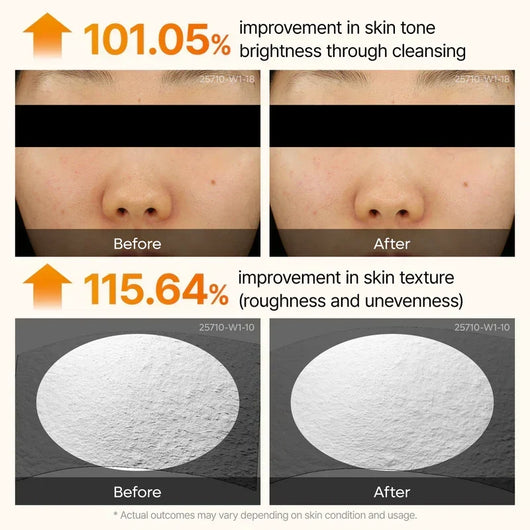 Summer Exclusive | 10-Step Skin Renewal Routine Set